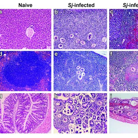 Histopathological Changes And Fibrosis In The Liver Spleen And