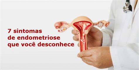 Sintomas Da Endometriose Que Voc N O Conhecia