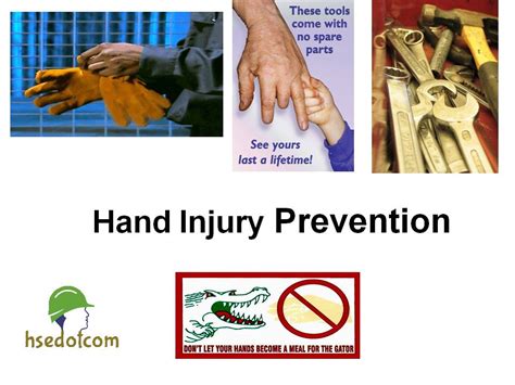 Hand Injury Safety