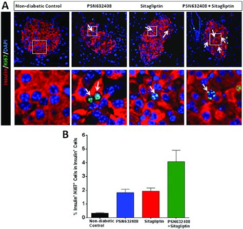 A Immunostaining Of Insulin Red Ki67 Green And DAPI Blue In