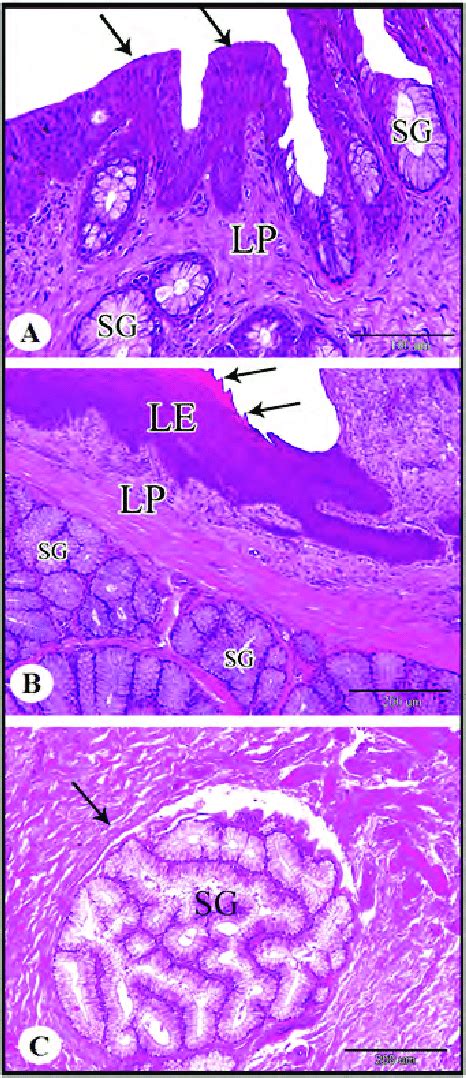 Photomicrograph Showing A Cross Section Of The Pharyngeal Roof Showing