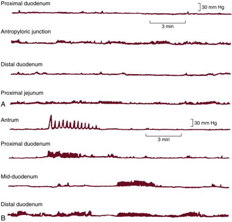 Development Of Gastrointestinal Motility Reflexes Abdominal Key