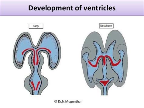 Development of ventricles © Dr.N.Mugunthan | Medical college, Brain ...