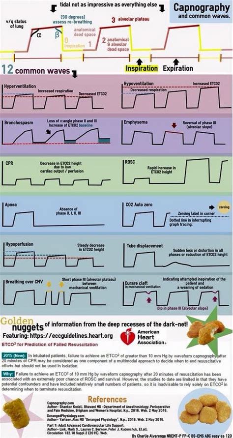 Pin by Nacho Redondo García on Anestesia Respiratory therapy student