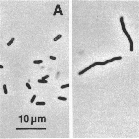 A Phase Contrast Micrographs Of Normal Cells 10 3m Kci And B