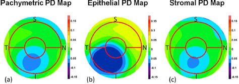 Average Pachymetric A Corneal Epithelial B And Stromal C