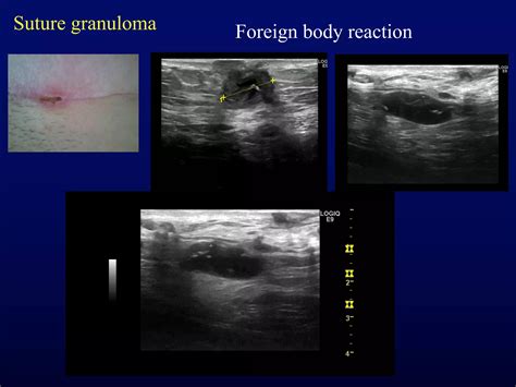 Msk need to know ultrasound lumps & bumps & various joints | PDF