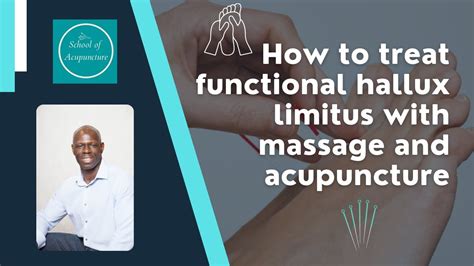 How To Treat Functional Hallux Limitus With Massage Myofascial Release And Acupuncture Youtube