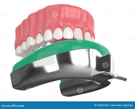 Mandibular Arch With Buccal Nerve Block Royalty Free Stock Image