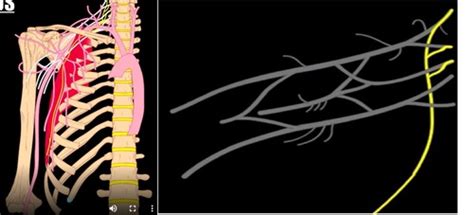 12 Brachial Plexus Muscular Innervation Pre Division Branches