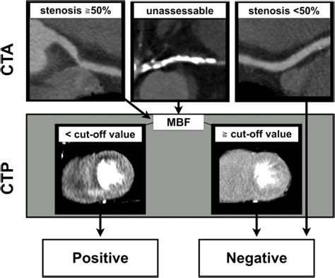 Incremental Diagnostic Value Of Whole Heart Dynamic Computed Tomography