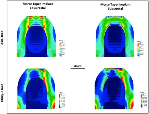 Von Mises Stress Distribution Within The Peri Implant Bone For The Download Scientific Diagram