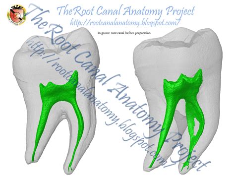 The Root Canal Anatomy Project Conservative Endodontic Access