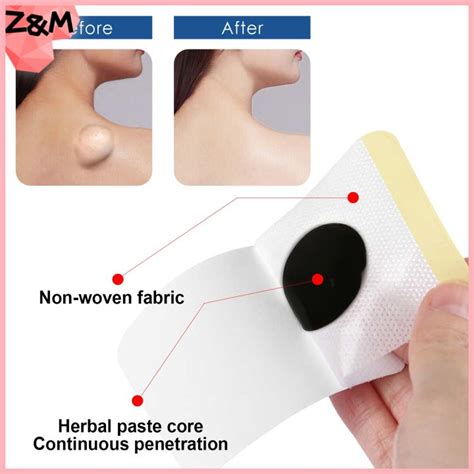 Zwmspecial Price Boxessouth Moon Lipoma Removal Care Sticker