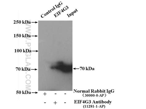 EIF4G3 Rabbit anti Human Mouse Rat Polyclonal Proteintech 150 μL