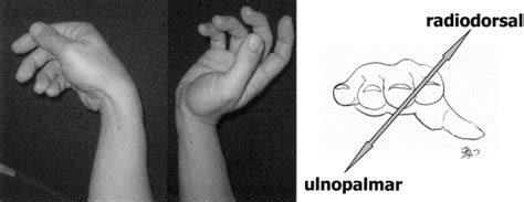 Capitate Based Kinematics Of The Midcarpal Joint During Wrist