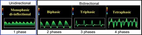 Doppler Us Of The Liver Made Simple Radiographics