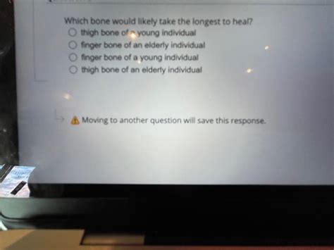 Solved Question 1 Ossification (Osteogenesin is the process | Chegg.com