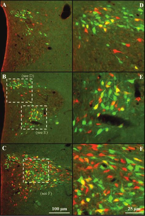 Examples Of Retrograde Labeling In The Ipsilateral Pvn At Different