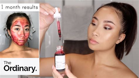 The Ordinary Peeling Solution 1 Month Use Youtube