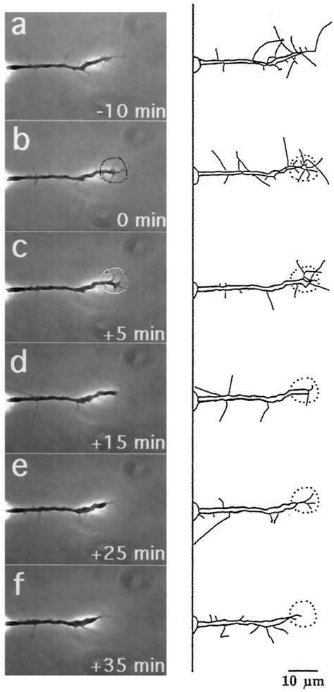 Micro Cali Of Ncam And L Simultaneously Causes Both Neurite