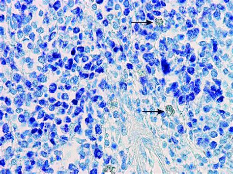 Boa Imperator Skin Histopathology Using Toluidine Blue Staining The