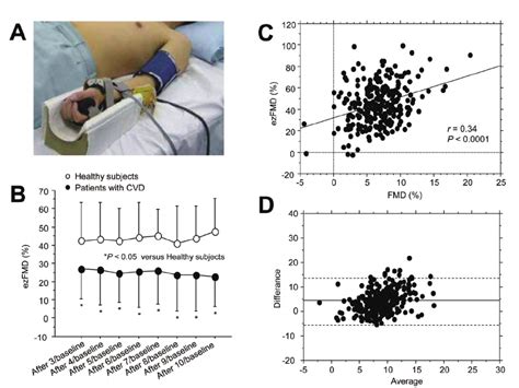 Measurement Of Enclosed Zone Flow Mediated Vasodilation Ezfmd A