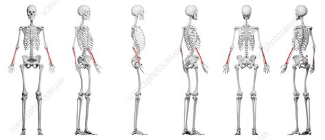 Radius bone, illustration - Stock Image - F038/2798 - Science Photo Library