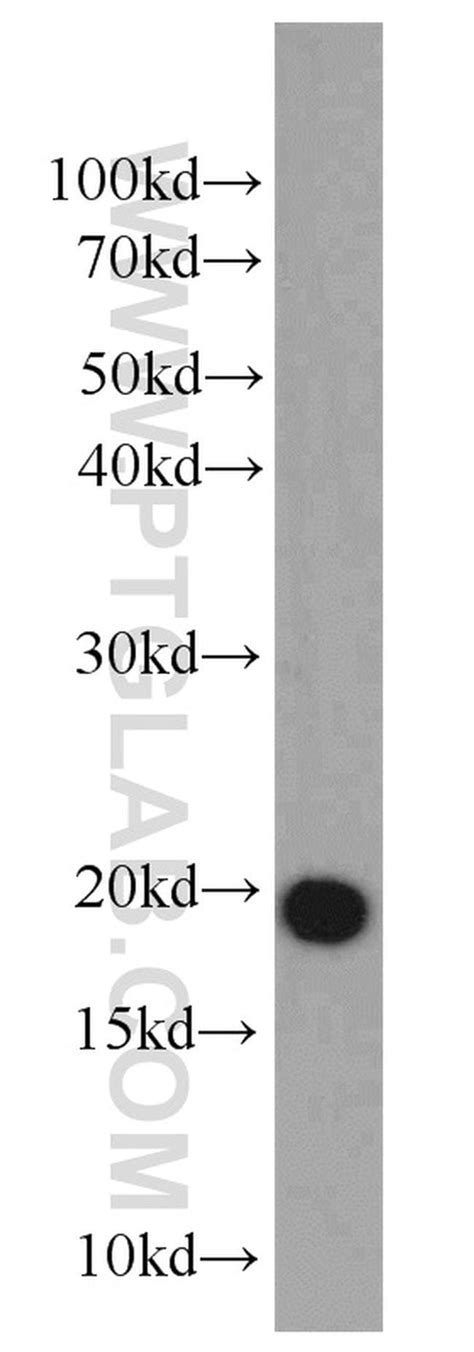 DR1 Rabbit anti Human Mouse Rat Polyclonal Proteintech 20 μL