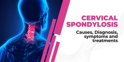 Cervical spondylosis: causes, Diagnosis, symptoms & treatments