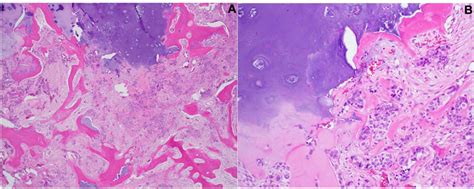 On Low Power Examination 4A Blue Nodules Of Relatively Mature