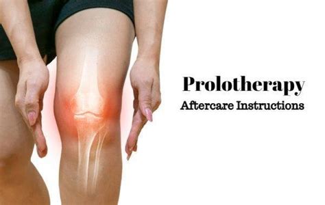 Aftercare Instructions For Prolotherapy Or Prp Joint Injections