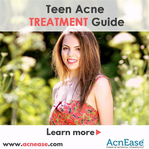 Teen Acne Treatment Guide | Blog