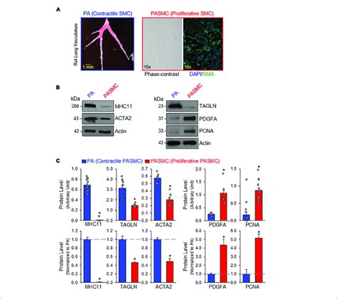 Contractile And Proliferative Phenotypes Of Pulmonary Arterial Smooth