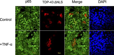 The Nls Mutated Tdp Does Not Affect P Nuclear Translocation Mcf