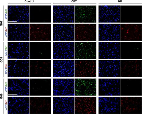 P Cip And P Kip Expression And Localization In Gsc Ecls Exposed