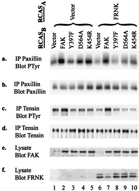 Tyrosine Phosphorylation Of Paxillin And Tensin In Cells Coexpressing