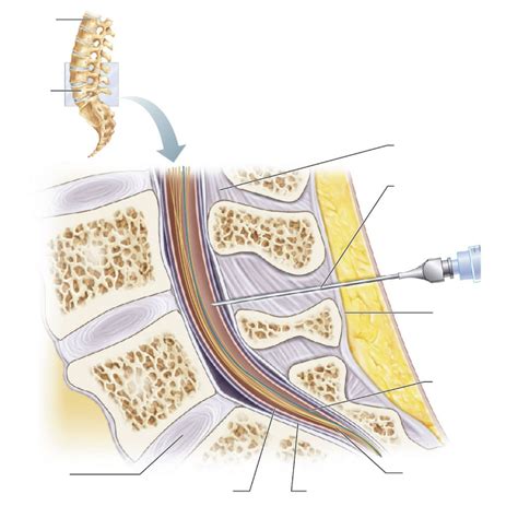 Lumbar Puncture Diagram Hot Sex Picture