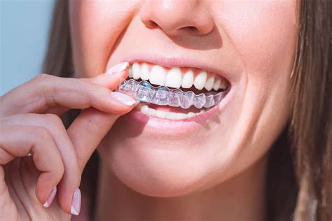 Benefits Of Clear Correct Invisible Aligners In Az Evdp