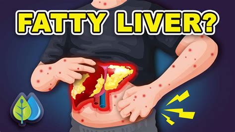 1 Powerful Way To Detox Fatty Liver Naturally