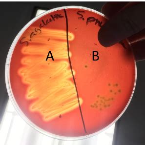 Microbiology Lab Practical Flashcards Quizlet