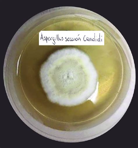 Cultivo De Aspergillus Secci N Candidi En Agar Sabouraud Glucosado