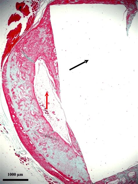 Histological Image Of Implant Site Six Weeks Goldner S Trichrome