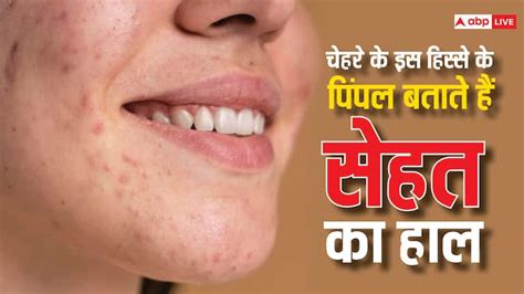 Pimples Reason चेहरे के इस हिस्से पर निकल रहे हैं दाने तो हल्के में न लें जानें कारण और इलाज