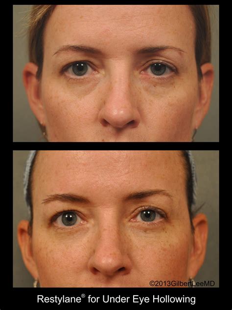 Changes Plastic Surgery San Diego Artistry With Precision Facial