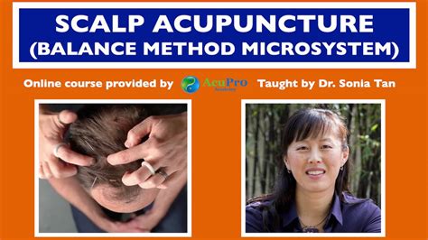 Scalp Acupuncture (a Balance System Holography Microsystem)