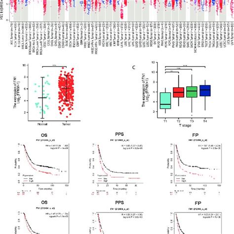 Fn1 Expression Levels In Different Types Of Human Cancers A Human