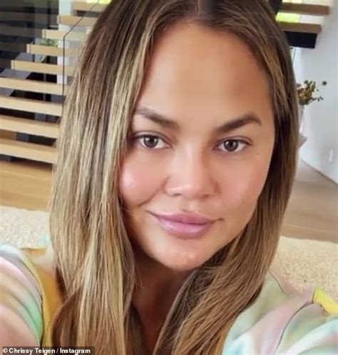 Chrissy Teigen Denies Getting Filler In Her Cheeks After Buccal Fat