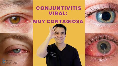 Conjuntivitis Viral Muy Contagiosa Youtube