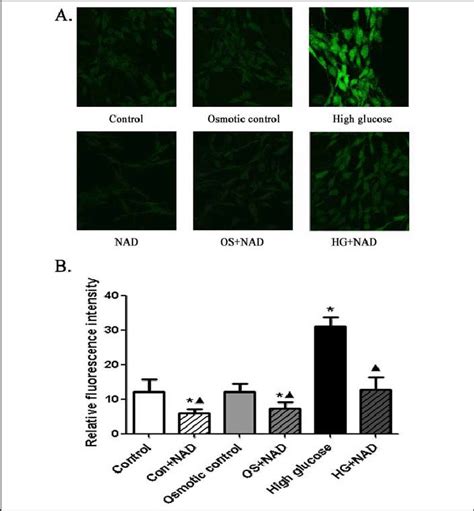 NAD Blocks The HG Induced Oxidative Stress Of Mesangial Hypertrophy